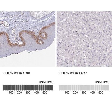 Anti-COL17A1 antibody produced in rabbit Prestige Antibodies&#174; Powered by Atlas Antibodies, affinity isolated antibody, buffered aqueous glycerol solution