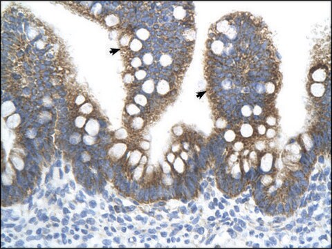 Anti-TFB2M (AB1) antibody produced in rabbit IgG fraction of antiserum