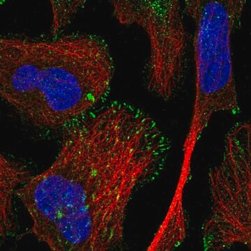 Anty-TRIM62 Prestige Antibodies&#174; Powered by Atlas Antibodies, affinity isolated antibody