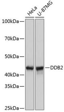 Anti-DDB2 antibody produced in rabbit