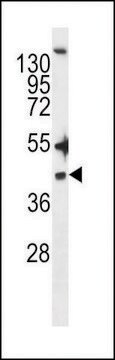 ANTI-ZDHHC20(N-TERMINAL) antibody produced in rabbit affinity isolated antibody, buffered aqueous solution