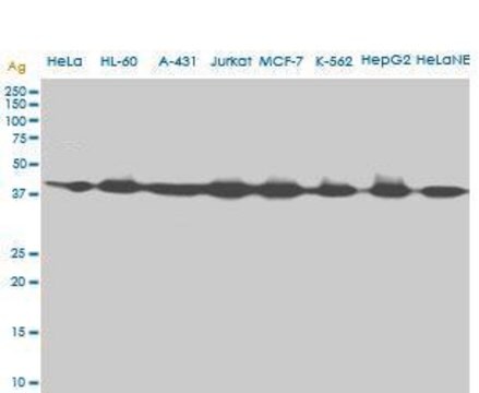 ANTI-AHCY antibody produced in mouse clone M2, purified immunoglobulin, buffered aqueous solution