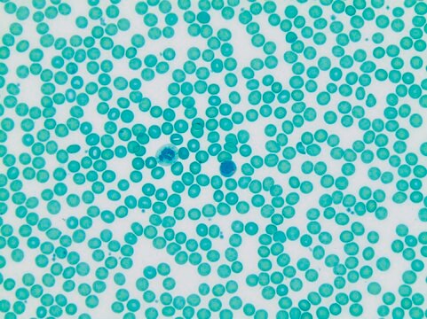 Lymphocyte &#945;-Naphthyl Butyrate Esterase Kit