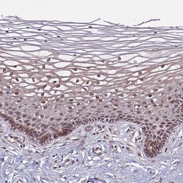 Anti-POLR2D antibody produced in rabbit Prestige Antibodies&#174; Powered by Atlas Antibodies, affinity isolated antibody, buffered aqueous glycerol solution