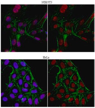 抗 JHDM1B 抗体 from rabbit, purified by affinity chromatography