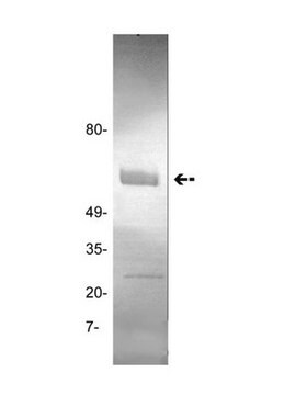 Anti-tPA-Antikörper (gewebespezifischer Plasminogenaktivator), Klon GMA-043 clone GMA-043, Upstate&#174;, from mouse