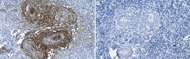 Anti-Tenascin Antibody, clone 1G4 ZooMAb&#174; Rabbit Monoclonal recombinant, expressed in HEK 293 cells