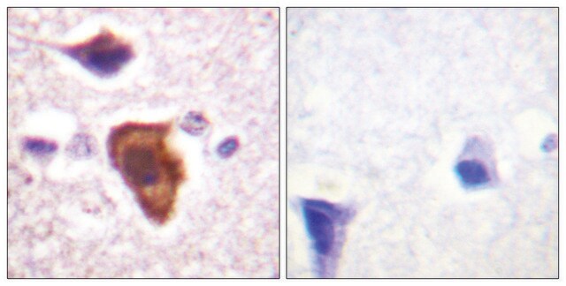 Anti-CD88 antibody produced in rabbit affinity isolated antibody