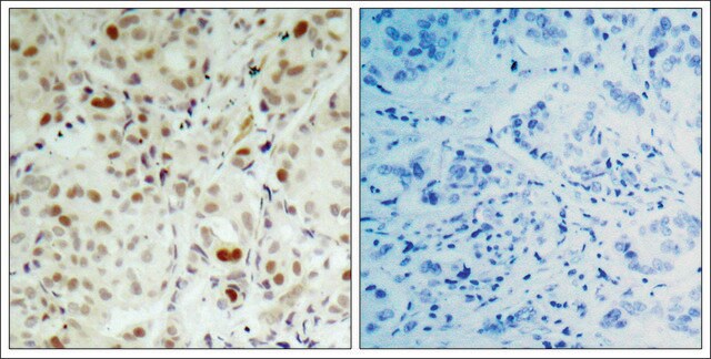 Anti-phospho-RB1 (pSer807) antibody produced in rabbit affinity isolated antibody