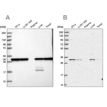 Anti-PSMA1 antibody produced in rabbit Prestige Antibodies&#174; Powered by Atlas Antibodies, affinity isolated antibody, buffered aqueous glycerol solution