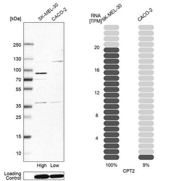 Anti-CPT2 antibody produced in rabbit Prestige Antibodies&#174; Powered by Atlas Antibodies, affinity isolated antibody, buffered aqueous glycerol solution, ab1