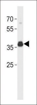 ANTI-ESR1 ISOFORM4 (C-TERM) antibody produced in rabbit affinity isolated antibody, buffered aqueous solution