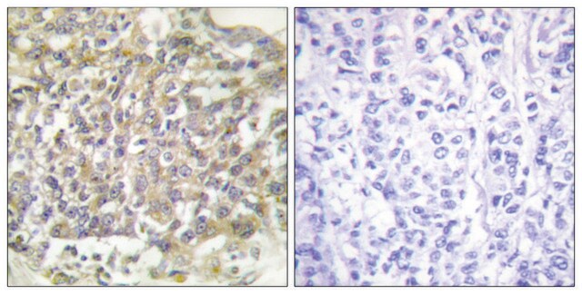 Anti-SHC antibody produced in rabbit affinity isolated antibody