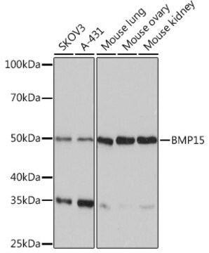 Anti-BMP15 Antibody, clone 6K5C3, Rabbit Monoclonal