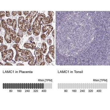 Monoclonal Anti-LAMC1 antibody produced in mouse Prestige Antibodies&#174; Powered by Atlas Antibodies, clone CL3199, purified immunoglobulin, buffered aqueous glycerol solution