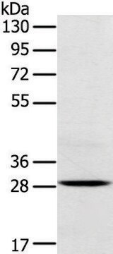 抗TREM2 affinity isolated antibody