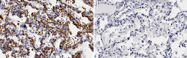 Anticorps anti-GLUT-1 (extrémité C-terminale) from rabbit, purified by affinity chromatography