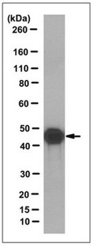 Anti-Potassium Channel Kir6.2 Antibody, clone 10C1.1 clone 10C1.1, from mouse