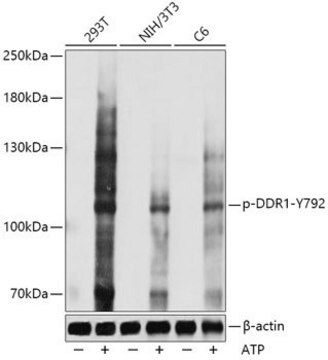 Anti-Phospho-DDR1-Y792 antibody produced in rabbit