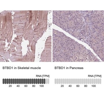 抗BTBD1抗体 ウサギ宿主抗体 Prestige Antibodies&#174; Powered by Atlas Antibodies, affinity isolated antibody, buffered aqueous glycerol solution