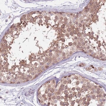 Anti-TYW1 antibody produced in rabbit Prestige Antibodies&#174; Powered by Atlas Antibodies, affinity isolated antibody, buffered aqueous glycerol solution