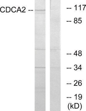 Anti-CDCA2 antibody produced in rabbit affinity isolated antibody