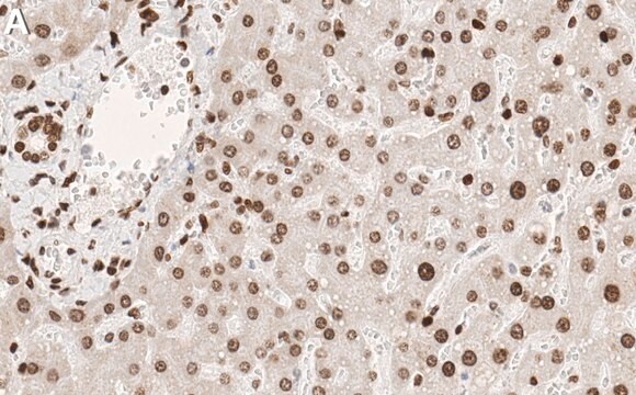 Anti-Ubiquityl H2B-Lys120 Antibody, clone 1F17 ZooMAb&#174; Rabbit Monoclonal recombinant, expressed in HEK 293 cells