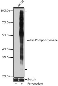 Anti-Pan Phospho-Tyrosine antibody produced in mouse