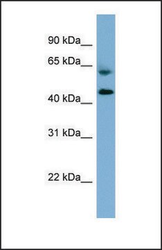 Anti-RMND1 antibody produced in rabbit affinity isolated antibody