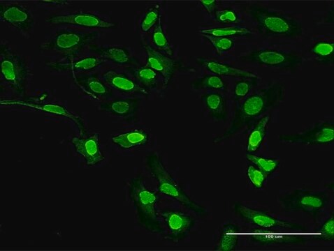 抗ALOX5 ウサギ宿主抗体 purified immunoglobulin, buffered aqueous solution