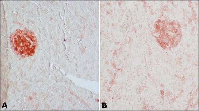 抗谷氨酸脱羧酶65（5-22） 兔抗 IgG fraction of antiserum, buffered aqueous solution