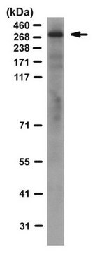 Anti-ATRX-Antikörper, Klon 39f clone 39F, from mouse