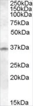 Anti-Cathepsin K antibody produced in goat affinity isolated antibody, buffered aqueous solution