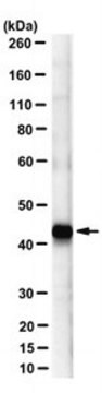 Anti-&#946;-Dystroglycan Antibody, clone 7D11