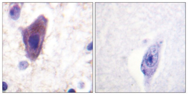 Anti-CD71 antibody produced in rabbit affinity isolated antibody