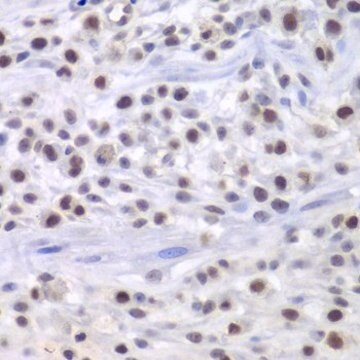 Anti-KAT1/HAT1 antibody produced in rabbit