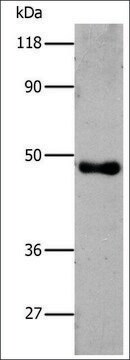 抗-6 His 兔抗 affinity isolated antibody