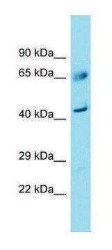 Anti-FAM83A (C-terminal) antibody produced in rabbit affinity isolated antibody