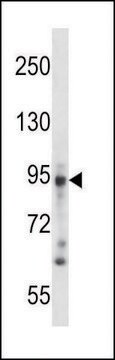 ANTI-DSG3 (N-TERM) antibody produced in rabbit IgG fraction of antiserum, buffered aqueous solution