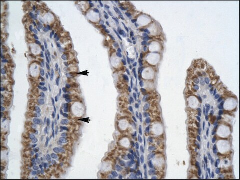 Anti-PITX2 IgG fraction of antiserum