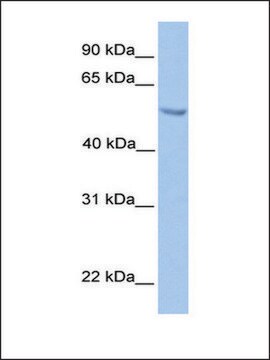 Anti-ETV5 antibody produced in rabbit affinity isolated antibody