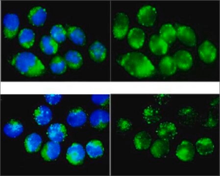 抗CAT抗体 ウサギ宿主抗体 affinity isolated antibody