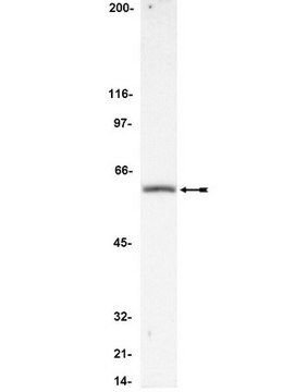 Anti-FLIP Antibody, CT Upstate&#174;, from rabbit