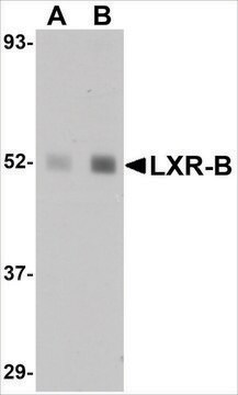 Anti-LXR-B antibody produced in rabbit affinity isolated antibody, buffered aqueous solution