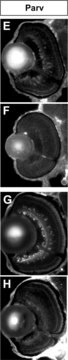 单克隆抗小白蛋白 小鼠抗 clone PARV-19, ascites fluid