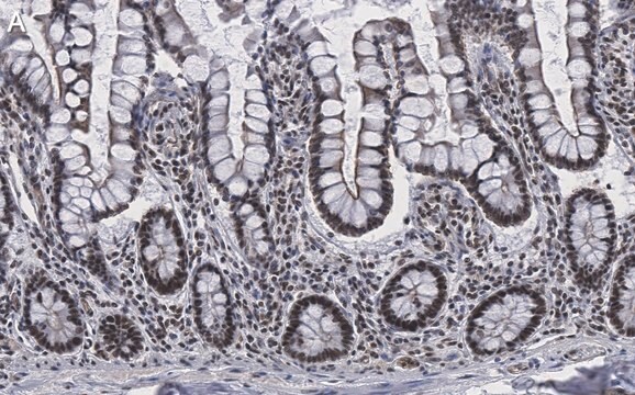 Anti-Brd4 Antibody, clone 1J17 ZooMAb&#174; Rabbit Monoclonal recombinant, expressed in HEK 293 cells