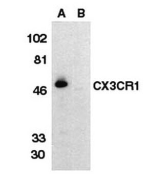 Anti-C-X-X-X-C-Chemokin-Rezeptor-1-Antikörper, extrazelluläre Schleife Chemicon&#174;, from rabbit