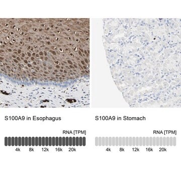 抗S100A9 ウサギ宿主抗体 Prestige Antibodies&#174; Powered by Atlas Antibodies, affinity isolated antibody, buffered aqueous glycerol solution