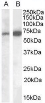 Anti-CADM4 (Internal) antibody produced in goat affinity isolated antibody, buffered aqueous solution