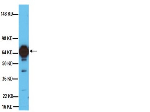 Anticorps anti-tyrosine hydroxylase, clone&nbsp;2/40/15 clone 2/40/15, Chemicon&#174;, from mouse